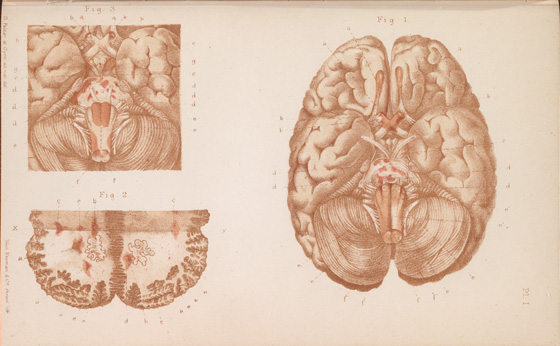 "Lectures on the diseases of the nervous system." by J.M. Charcot