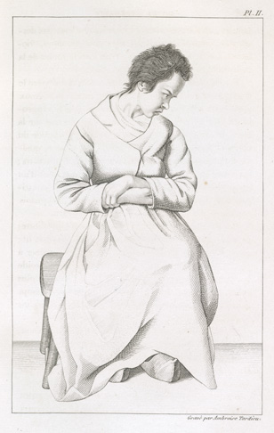 [Patient affected by mania before treatment]