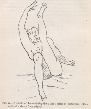 "Lectures on the diseases of the nervous system." by J.M. Charcot