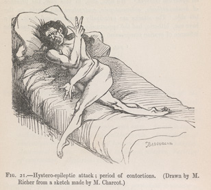 "Lectures on the diseases of the nervous system." by J.M. Charcot
